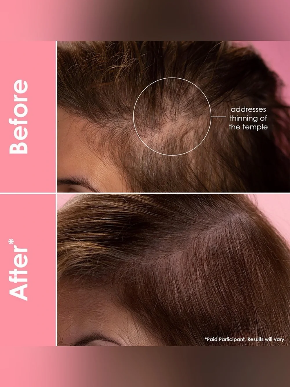 GRANDE HAIR FULL BOOST STARTER KIT•Scalp Care+Hair Repair Complexes•4 Pcs. NIB!